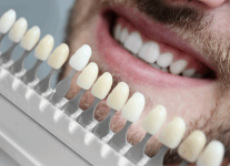 Smile nambour_image1-1024x745.png