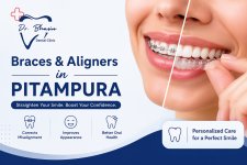 Braces & Aligners in Pitampura.jpg